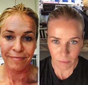 Chelsea Handler before and after makeup