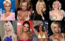 10 Most Popular Celebrity Breast Implants of All Time