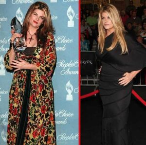 Before and after weight loss picture of Kirstie Alley
