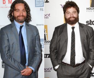 Before and after weight loss picture of Zak Galifianakis