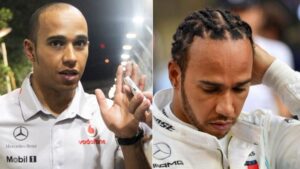 Lewis Hamilton before and after hair transplant